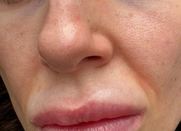 🧴 Спасение для сухой и чувствительной кожи: обзор BIODERMA Atoderm Ultra